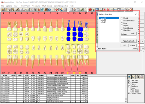 Charting Surfaces Across Multiple Teeth at the Same Time | Dentrix ...