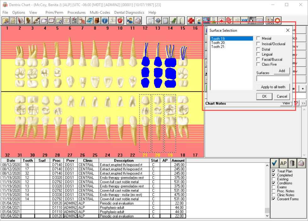 Charting Surfaces Across Multiple Teeth at the Same Time Dentrix